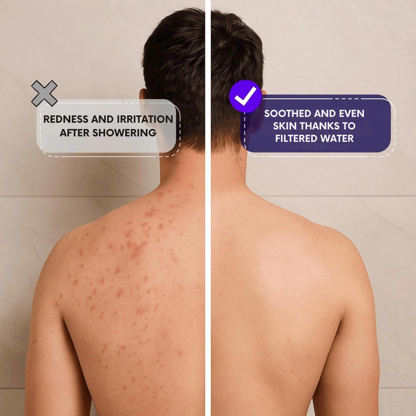 Elektraze™ - The Filtered Showerhead